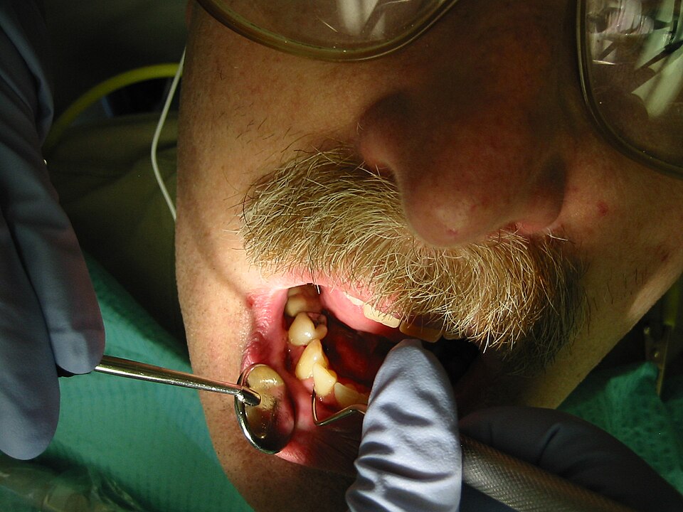 Procedure Type