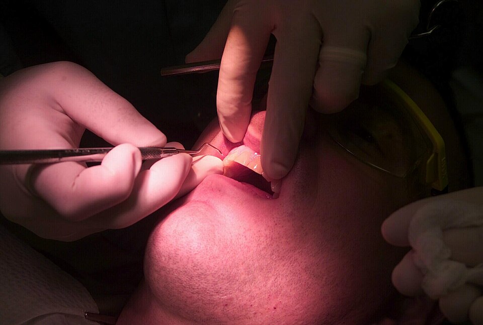 Dallas Laser Dentistry